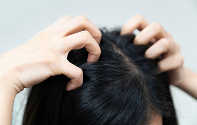 What Causes Dry Scalp?