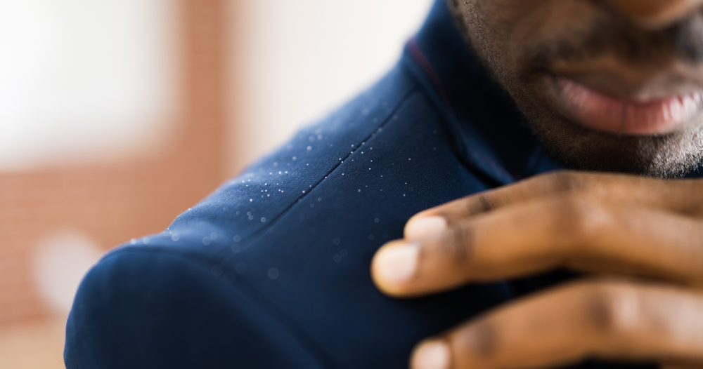 What Causes Dandruff?