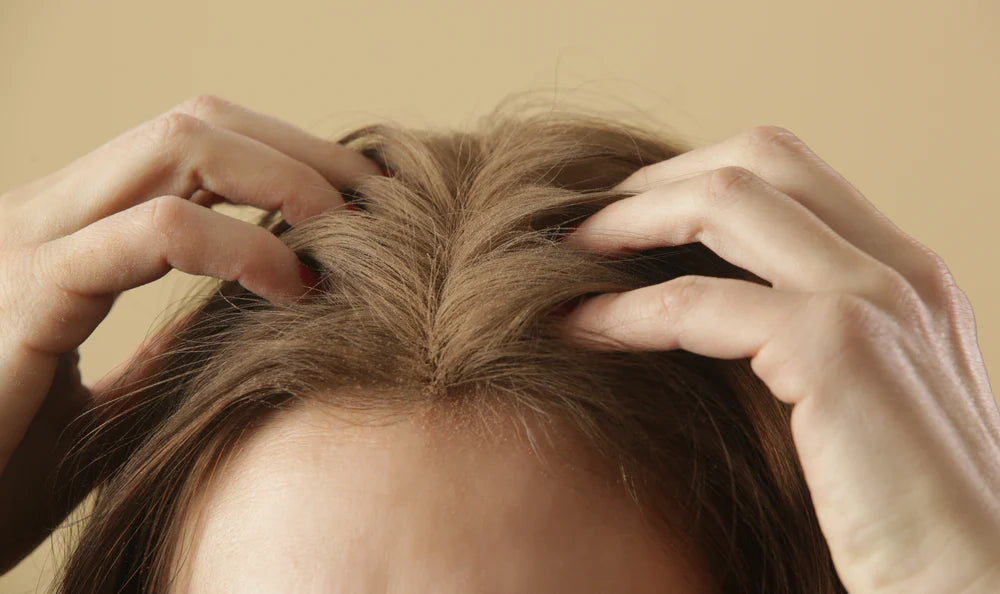 unique remedies for scalp psoriasis scratch prevention