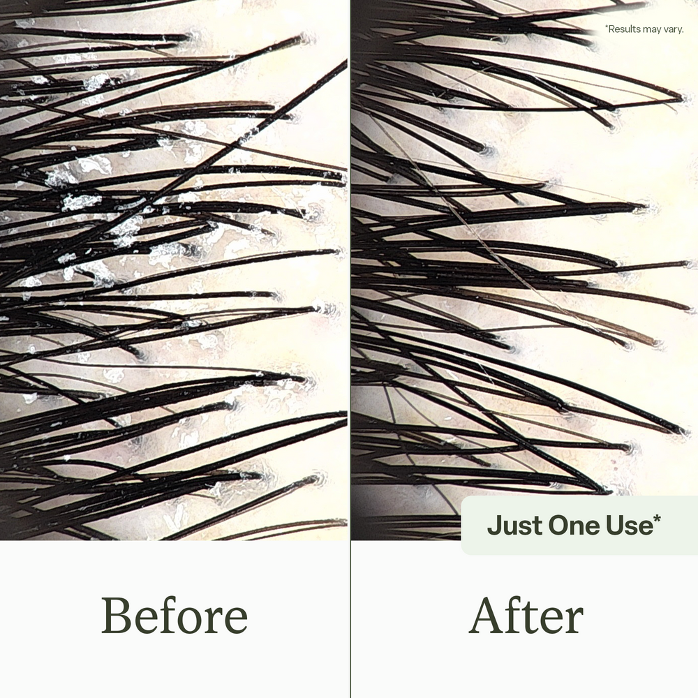 Scalp Reset Shampoo