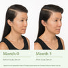 Scalp Serum + Free Travel-Sized Dry Shampoo