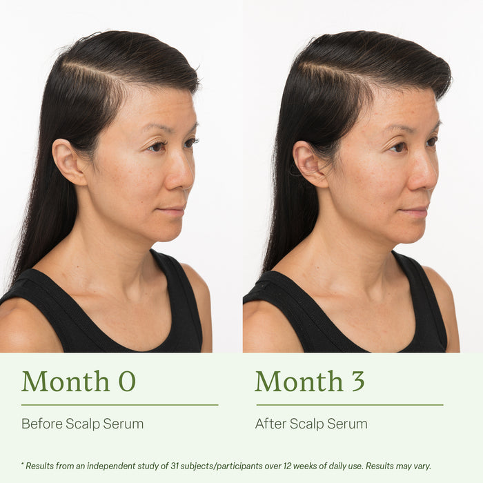 Scalp Serum + Free Travel-Sized Dry Shampoo