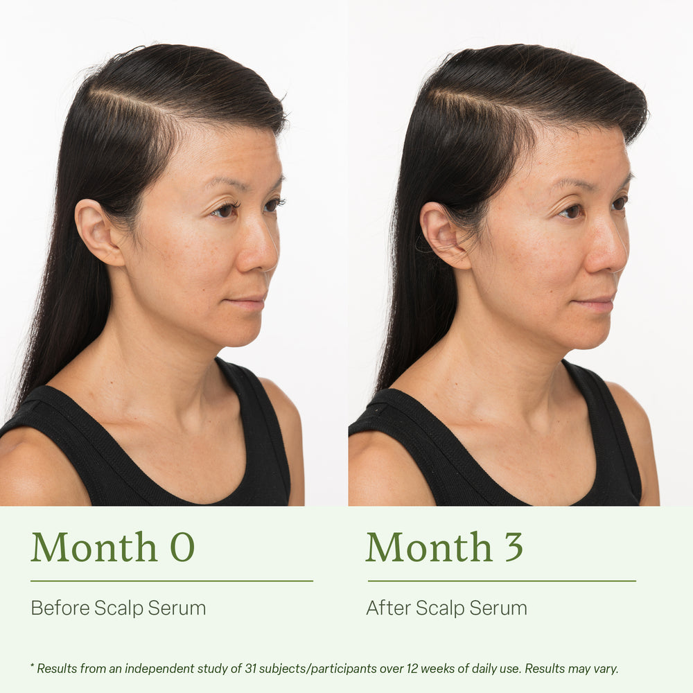 Struggling with thinning or shedding hair?