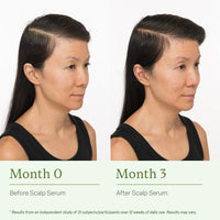 15ml Scalp Serum